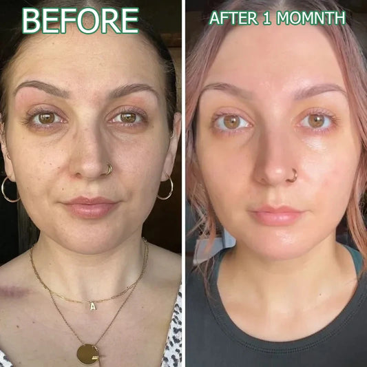 New Advanced Exosome Anti-Wrinkle Cream | Reedle Shot Official